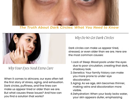 The Truth About Dark Circles: What You Need to Know